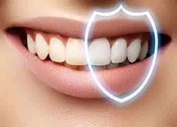 Blanqueamiento Dental