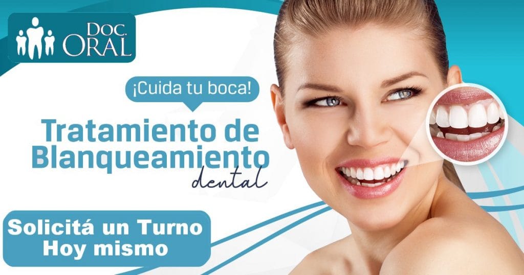 Blanqueamiento dental - Reservar un turno - Consultorio Odontológico Córdoba