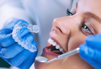 Blanqueamiento Dental en Córdoba - Clinica Dental