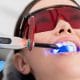 Blanqueamiento Dental - Precio en Córdoba